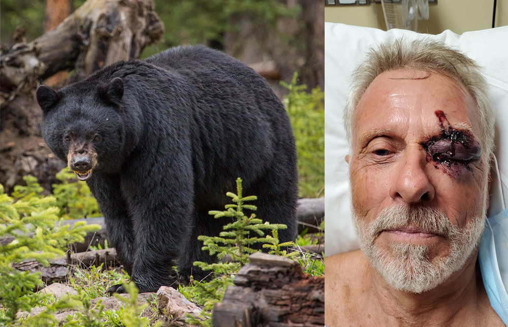 Black bear attack in the Trinity Alps of Northern California: hiker and survivor Ken DeCamp.
